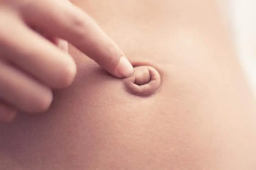 Göbek Fıtığı Ameliyatından Sonra Tekrar Eder mi? Göbek Fıtığı Ameliyatından Sonra Tekrar Eder mi?